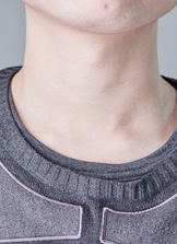 关注甲状腺健康