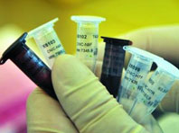 禽流感要隔离吗